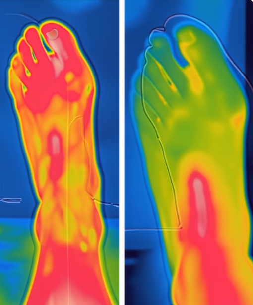 Stimowell - Stimolatore plantare per il Benessere del Piede
